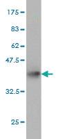 Anti-TTC8 Mouse Monoclonal Antibody [clone: 7E2]