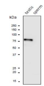 Anti-PDILT antibody