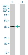 Anti-PSMB5 Rabbit Polyclonal Antibody