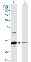 Anti-UBE2T Mouse Monoclonal Antibody [clone: 4G1-4C2]