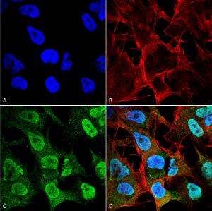 Immunocytochemistry/Immunofluorescence analysis of human neuroblastoma cell line (SK-N-BE, fixed in 4% formaldehyde for 15 min at room temperature, using Anti-alpha Synuclein Antibody [4F1] (A304962), at 1:100 for 60 minutes at room temperature