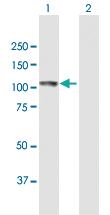 Anti-ECE1 Mouse Polyclonal Antibody