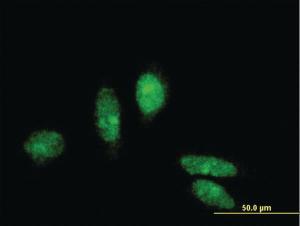 Anti-MTA3 Mouse Monoclonal Antibody [clone: 3B3]