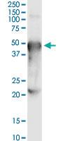 Anti-PORCN Rabbit Polyclonal Antibody