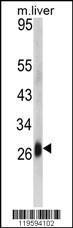 Anti-CD302 Rabbit Polyclonal Antibody (PE (Phycoerythrin))