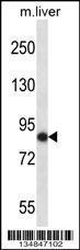 Anti-NEK5 Rabbit Polyclonal Antibody (AP (Alkaline Phosphatase))