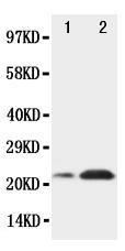 Anti-SOCS2 Rabbit Polyclonal Antibody