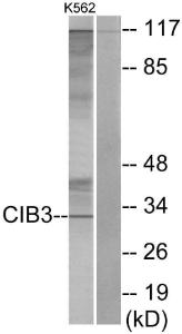 Anti-CIB3 antibody