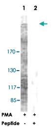 Anti-ACACA Rabbit Polyclonal Antibody