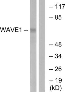 Western blot analysis of lysates from 293 cells, treated with insulin 0.01U/ml 15' using Anti-WAVE1 Antibody. The right hand lane represents a negative control, where the antibody is blocked by the immunising peptide