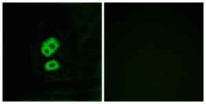 Immunofluorescence analysis of MCF7 cells using Anti-OR2T10 Antibody The right hand panel represents a negative control, where the antibody was pre-incubated with the immunising peptide