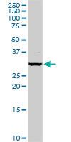 Anti-PSMB5 Rabbit Polyclonal Antibody