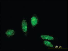 Anti-MTA3 Mouse Monoclonal Antibody [clone: 3B3]