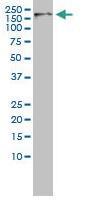 Anti-CDK13 Mouse monoclonal antibody [clone: 10B2175]