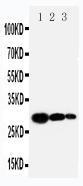 Anti-TIMP1 Rabbit Polyclonal Antibody