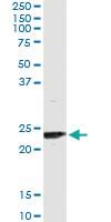 Anti-UBE2T Mouse Monoclonal Antibody [clone: 4G1-4C2]