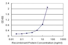 Anti-OXSR1 Antibody Pair