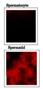 Anti-PDILT antibody