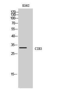 Anti-CIB3 antibody