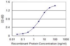 Anti-HOXA9 Mouse Monoclonal Antibody [clone: 2A11-2D2]