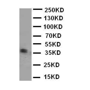 Anti-Kallikrein 5 Rabbit Polyclonal Antibody