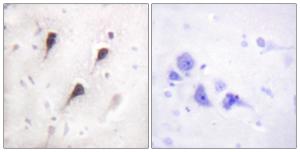 Immunohistochemical analysis of paraffin-embedded human brain tissue using Anti-WAVE1 Antibody. The right hand panel represents a negative control, where the antibody was pre-incubated with the immunising peptide