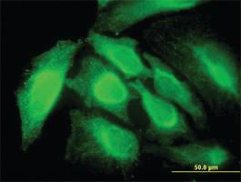 Anti-RNF14 Mouse Monoclonal Antibody [clone: 4G9]