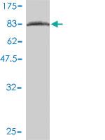 Anti-OXSR1 Mouse Monoclonal Antibody [clone: 2A2-1A2]