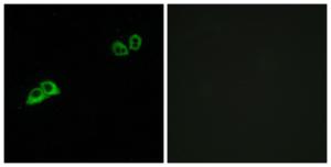 Immunofluorescence analysis of MCF7 cells using Anti-OR2AT4 Antibody The right hand panel represents a negative control, where the antibody was pre-incubated with the immunising peptide