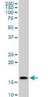 Anti-ACP1 Mouse Monoclonal Antibody [clone: 2A3]