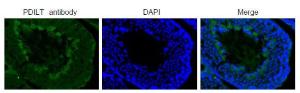 Anti-PDILT antibody