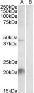 Anti-Klk6 antibody