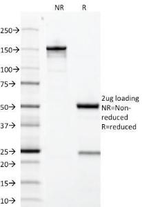 SDS-PAGE analysis of Anti-Growth Hormone Antibody [GH/1371] under non-reduced and reduced conditions; showing intact IgG and intact heavy and light chains, respectively. SDS-PAGE analysis confirms the integrity and purity of the antibody