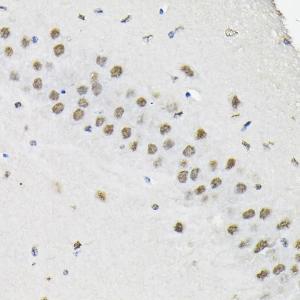 Immunohistochemistry analysis of paraffin-embedded mouse brain using Anti-HNRNPA3 Antibody (A309027) at a dilution of 1:100 (40X lens). Perform high pressure antigen retrieval with 10 mM citrate buffer pH 6.0 before commencing with IHC staining protocol