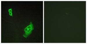 Immunofluorescence analysis of COS7 cells using Anti-WAVE1 Antibody. The right hand panel represents a negative control, where the antibody was pre-incubated with the immunising peptide