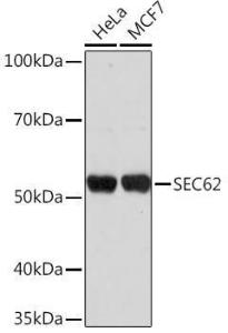 Western blot analysis of extracts of various cell lines, using Anti-SEC62 Antibody (A306102) at 1:1,000 dilution. The secondary antibody was Goat Anti-Rabbit IgG H&L Antibody (HRP) at 1:10,000 dilution.