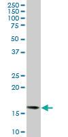 Anti-ACP1 Mouse Monoclonal Antibody [clone: 2A3]