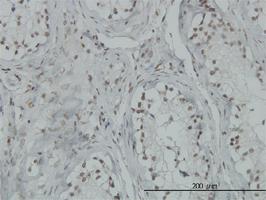 Anti-TP53BP2 Mouse Monoclonal Antibody [clone: 3F8]