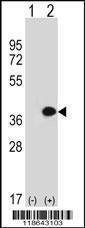 Anti-MLF1 Rabbit Polyclonal Antibody (FITC (Fluorescein Isothiocyanate))