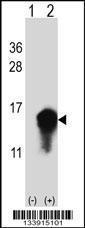 Anti-CSTA Rabbit Polyclonal Antibody (AP (Alkaline Phosphatase))