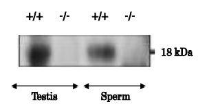 Anti-PMIS2 Antibody