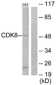 Western blot analysis of lysates from 293 cells using Anti-CDK8 Antibody. The right hand lane represents a negative control, where the Antibody is blocked by the immunising peptide