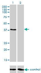 Anti-RNF14 Mouse Monoclonal Antibody [clone: 4G9]