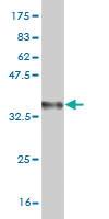 Anti-OXSR1 Mouse Monoclonal Antibody [clone: 1C8]