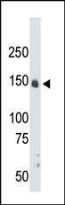 Anti-CDK12 Rabbit polyclonal antibody