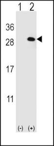 Anti-EIF4E2 Rabbit polyclonal antibody