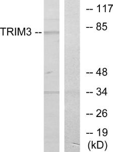 Western blot analysis of lysates from COLO cells using Anti-TRIM3 Antibody. The right hand lane represents a negative control, where the antibody is blocked by the immunising peptide