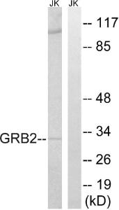 Western blot analysis of lysates from Jurkat cells using Anti-GRB2 Antibody. The right hand lane represents a negative control, where the Antibody is blocked by the immunising peptide