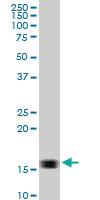 Anti-ACP1 Mouse Monoclonal Antibody [clone: 2A3]