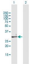 Anti-ECH1 Mouse Polyclonal Antibody